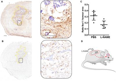 The Multifarious Role of Microglia in Brain Metastasis